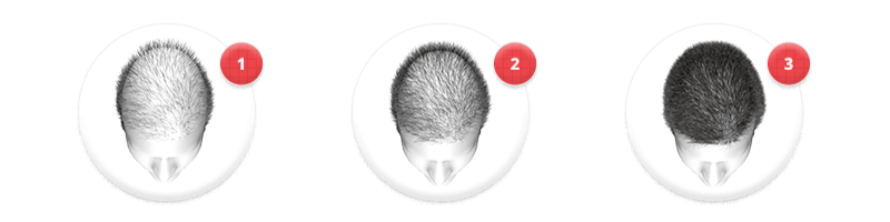 hair loss blocker funciona mesmo